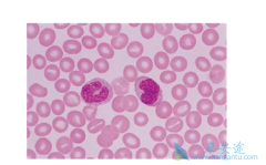 ������Ѫ��������һ��ʲô����