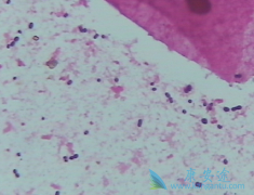 ˹��/��������ѪС�����Ŀǰ����ͳһ����ϱ�׼